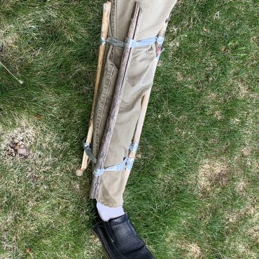 Leg splint 2